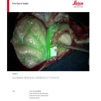 案例研究：GLOW800 增強(qiáng)現(xiàn)實(shí)在煙霧病治療中的應(yīng)用