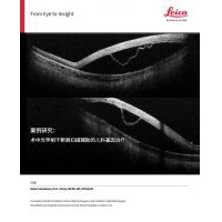 案例研究： 術(shù)中光學(xué)相干斷層掃描輔助的兒科基因治療