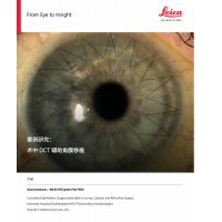 術(shù)中OCT輔助角膜移植