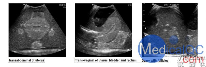 CIrs 404A女性盆腔模体，CIrs 404A超声训练骨盆模体影像图