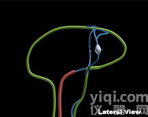 WEK-BV腦血管模體,Brain Vessels模體定制,腦腫瘤血管模體