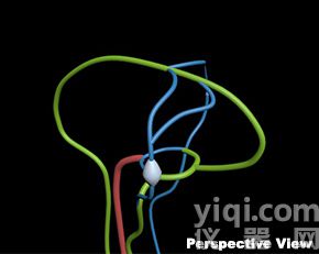 WEK-BV腦血管模體,Brain Vessels模體定制,腦腫瘤血管模體