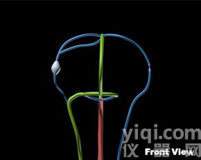 WEK-BV腦血管模體,Brain Vessels模體定制,腦腫瘤血管模體