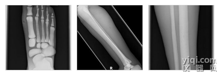 LG-A02成人腿部模體,LG-A02男性腿部模型成像效果