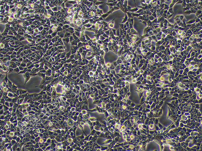 人結腸癌細胞；HCT-116.jpg