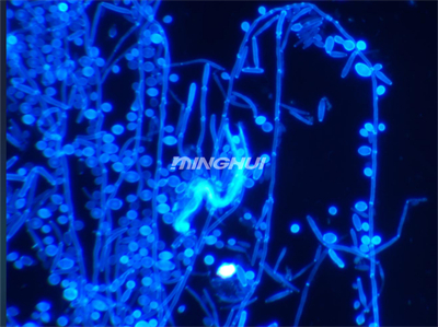 明慧UB203i-FL真菌熒光顯微鏡+MHD600顯微相機(jī)實(shí)拍效果圖3